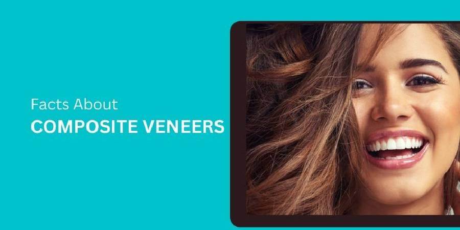 Facts About Composite Veneers That You Need To Be Aware Of